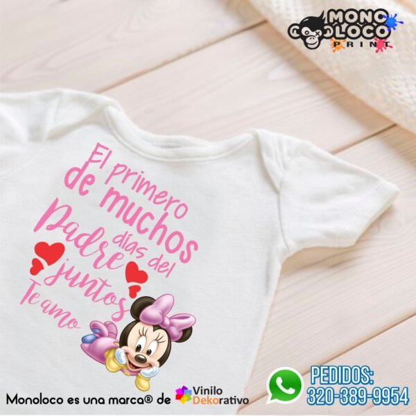 Body BDP14